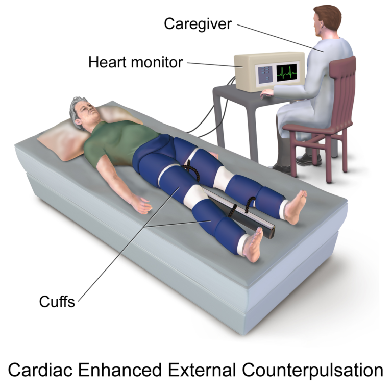 Ozone / Chelation / EECP / Cardiology Treatment